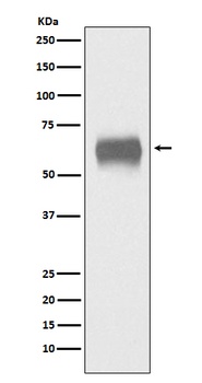 CD5 Rabbit Monoclonal Antibody