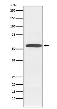 Cytochrome P450 2D6 CYP2D6 Rabbit Monoclonal Antibody