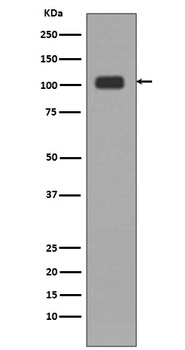 KDM1/LSD1 (KDM1A) Rabbit Monoclonal Antibody