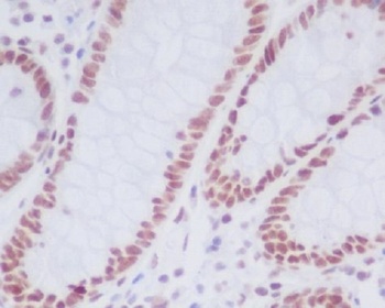 KDM1/LSD1 (KDM1A) Rabbit Monoclonal Antibody
