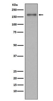 MSH6/Gtbp Rabbit Monoclonal Antibody
