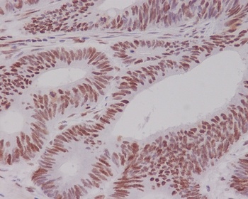 MSH6/Gtbp Rabbit Monoclonal Antibody