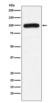 UBE3A Rabbit Monoclonal Antibody