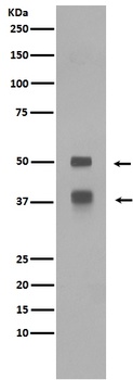 LEF1 Rabbit Monoclonal Antibody