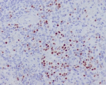 LEF1 Rabbit Monoclonal Antibody