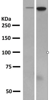 DNA-PKcs/PRKDC Rabbit Monoclonal Antibody