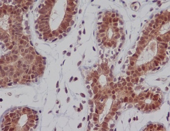 DNA-PKcs/PRKDC Rabbit Monoclonal Antibody