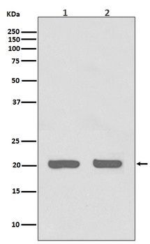 IL1RA Rabbit Monoclonal Antibody