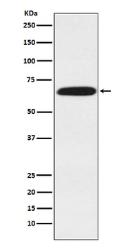 DDX5 Rabbit Monoclonal Antibody
