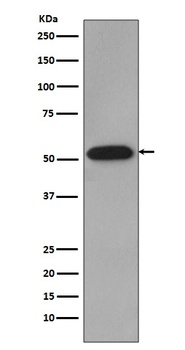 Cyclin B1 CCNB1 Rabbit Monoclonal Antibody