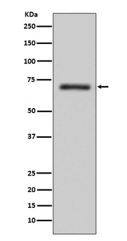 FUS/TLS Rabbit Monoclonal Antibody