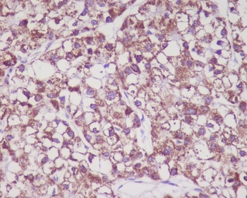 MMP3 Rabbit Monoclonal Antibody