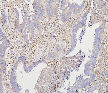 Collagen III/COL3A1 Antibody (monoclonal, 9H9)
