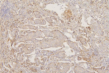 Collagen III/COL3A1 Antibody (monoclonal, 9H9)