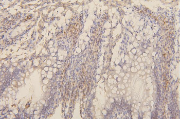 Collagen III/COL3A1 Antibody (monoclonal, 9H9)