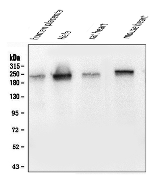 Collagen III/COL3A1 Antibody (monoclonal, 9H9)