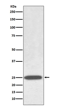 AQP1 Rabbit Monoclonal Antibody