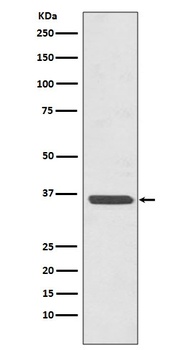 Annexin A2 ANXA2 Rabbit Monoclonal Antibody