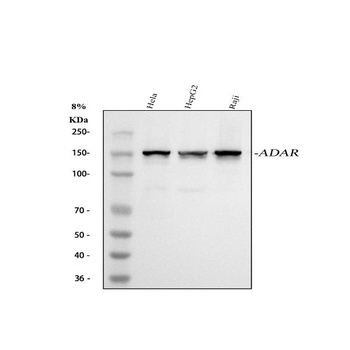 ADAR1 Rabbit Monoclonal Antibody