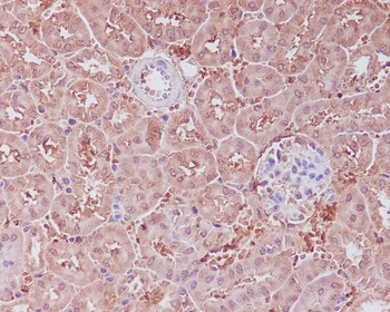 APAF1 Rabbit Monoclonal Antibody