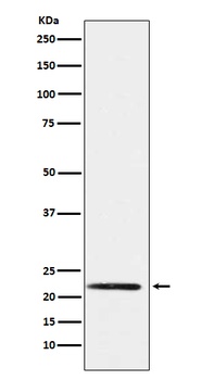 PMP22 Rabbit Monoclonal Antibody