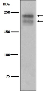 VEGF Receptor 2 KDR Rabbit Monoclonal Antibody