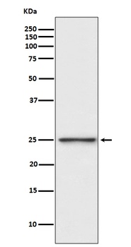 PGP9.5/PGP9 Rabbit Monoclonal Antibody