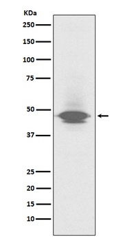 CD79a Rabbit Monoclonal Antibody