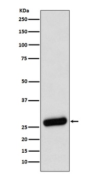 SDHB Rabbit Monoclonal Antibody