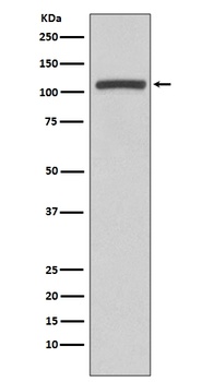 PI3 Kinase p110 beta PIK3CB Rabbit Monoclonal Antibody