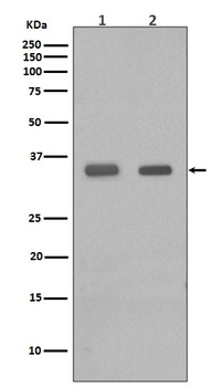 CEBP Beta Rabbit Monoclonal Antibody