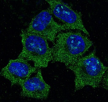 Hsp90 alpha HSP90AA1 Rabbit Monoclonal Antibody