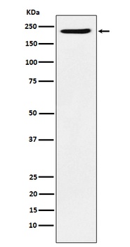 PBRM1 Rabbit Monoclonal Antibody