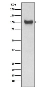 VCAM1/Cd106 Rabbit Monoclonal Antibody