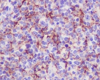 VCAM1/Cd106 Rabbit Monoclonal Antibody