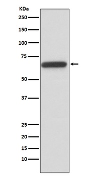 HNF1 beta Rabbit Monoclonal Antibody