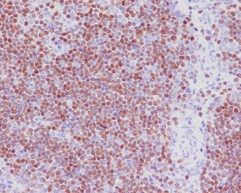 SATB1 Rabbit Monoclonal Antibody