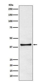 TRIB3 Rabbit Monoclonal Antibody