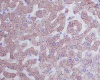 Cytokeratin 8/KRT8 Rabbit Monoclonal Antibody