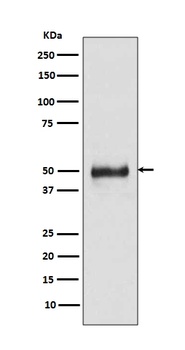 Cytokeratin 8/KRT8 Rabbit Monoclonal Antibody