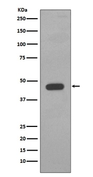 Cytokeratin 14/KRT14 Rabbit Monoclonal Antibody