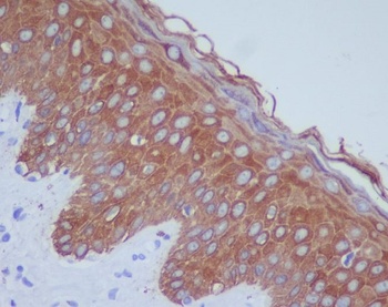 Cytokeratin 14/KRT14 Rabbit Monoclonal Antibody