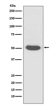 Cytokeratin 14/KRT14 Rabbit Monoclonal Antibody