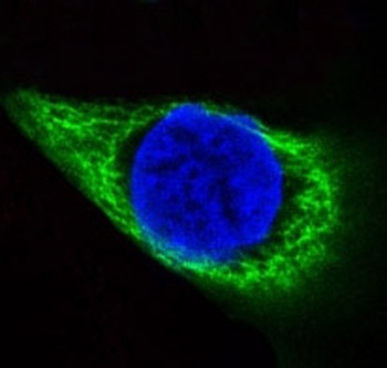 Cytokeratin 14/KRT14 Rabbit Monoclonal Antibody