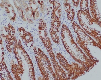 Cytokeratin 14/KRT14 Rabbit Monoclonal Antibody