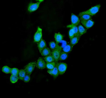 AIF/AIFM1 Antibody (monoclonal, 2I5)