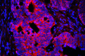 AIF/AIFM1 Antibody (monoclonal, 2I5)