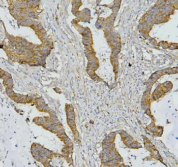 AIF/AIFM1 Antibody (monoclonal, 2I5)