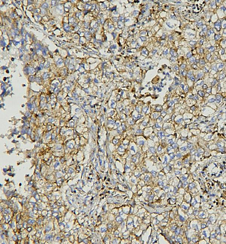 AIF/AIFM1 Antibody (monoclonal, 2I5)