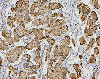 AIF/AIFM1 Antibody (monoclonal, 2I5)